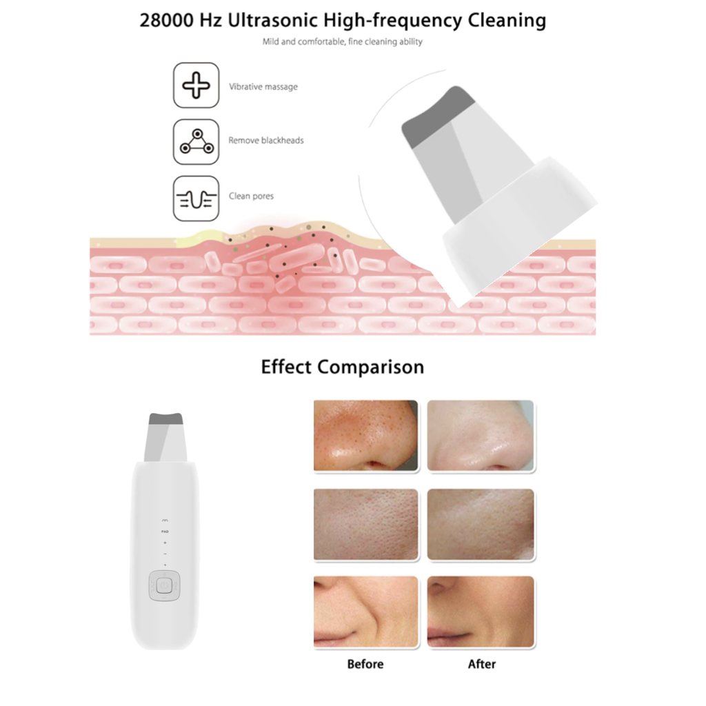 Ultrasonic Ion Deep Cleansing Facial Wand